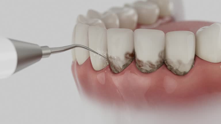 Reliable Dental Implants contractor in New Haven, CT by Smile Center Dentistry